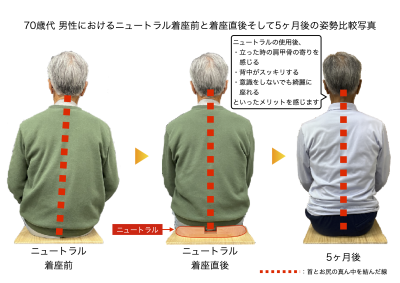 骨盤コントロール補助器【ニュートラル】